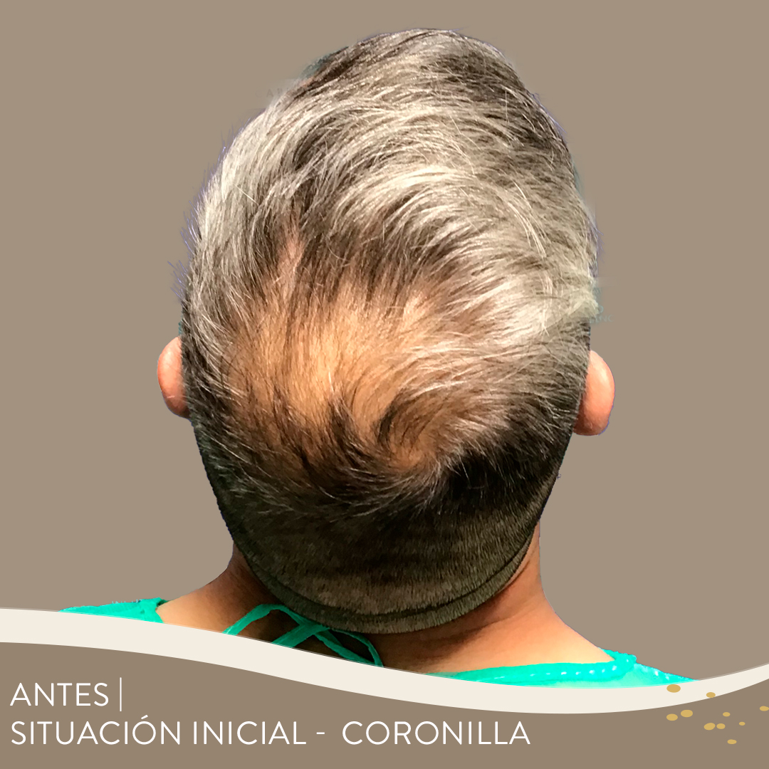 Casos 19 antesdespues 01 1