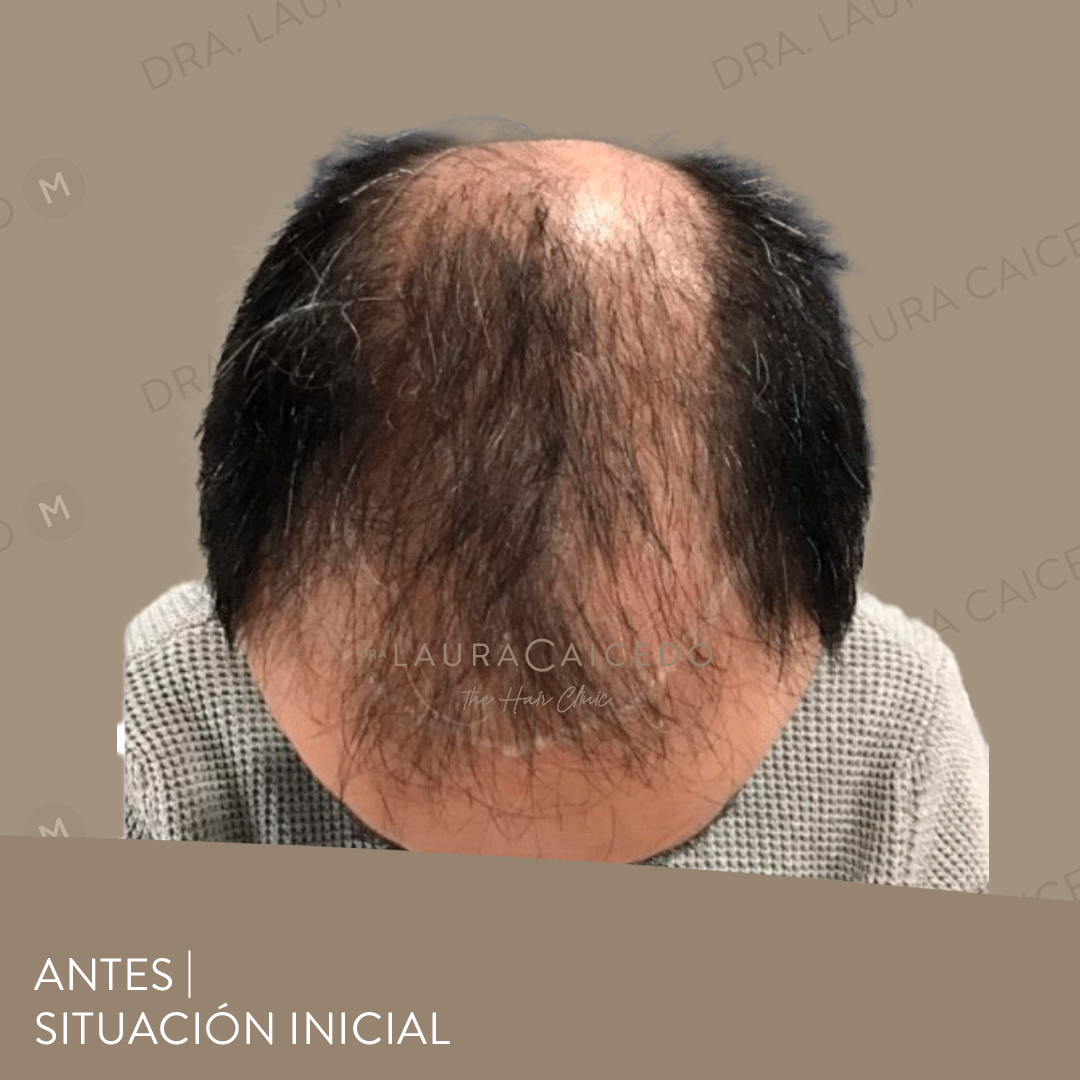 Casos 15 antesdespues 01 04