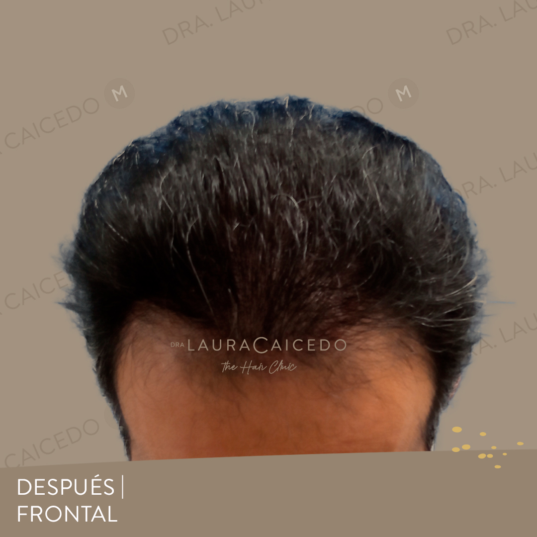 Casos 16 antesdespues 01 07