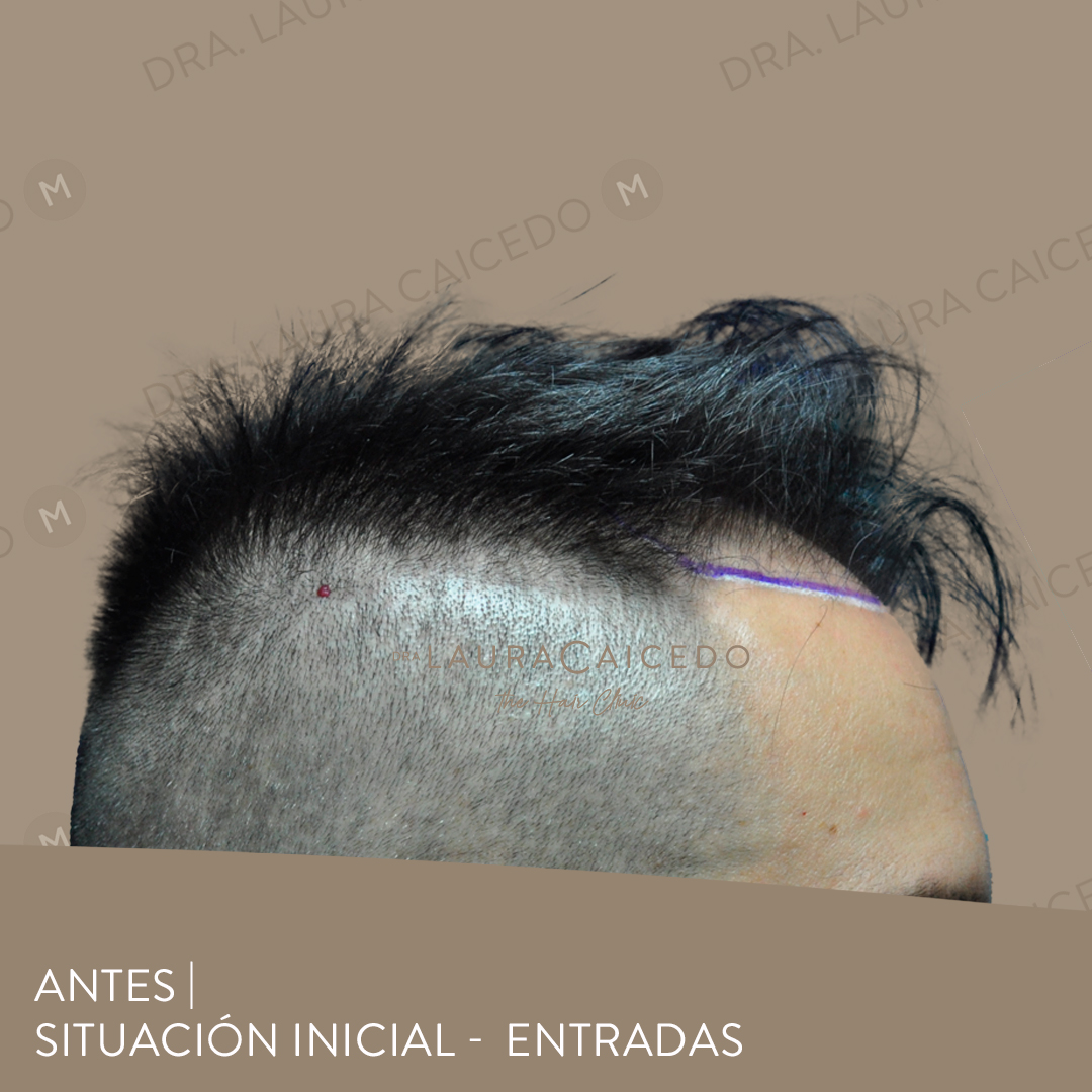 Casos 13 antesdespues 04 1
