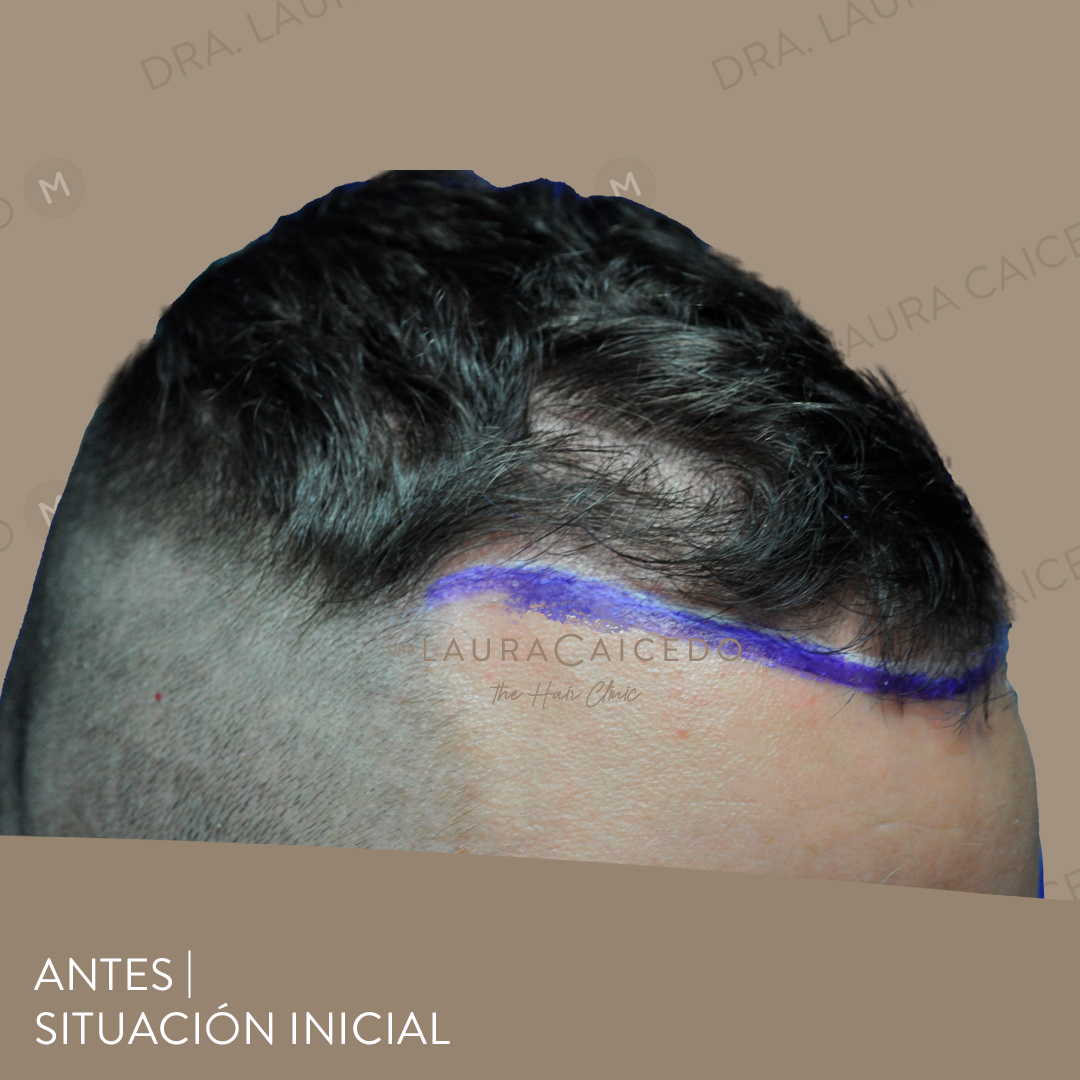 Casos 21 antesdespues 04