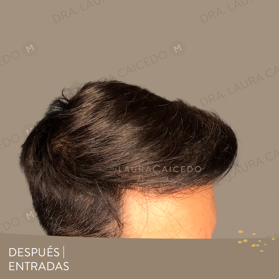 Casos 14 antesdespues 05 1