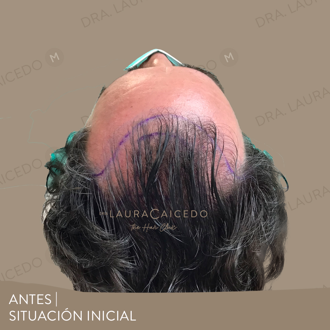 Casos 17 antesdespues 06 1