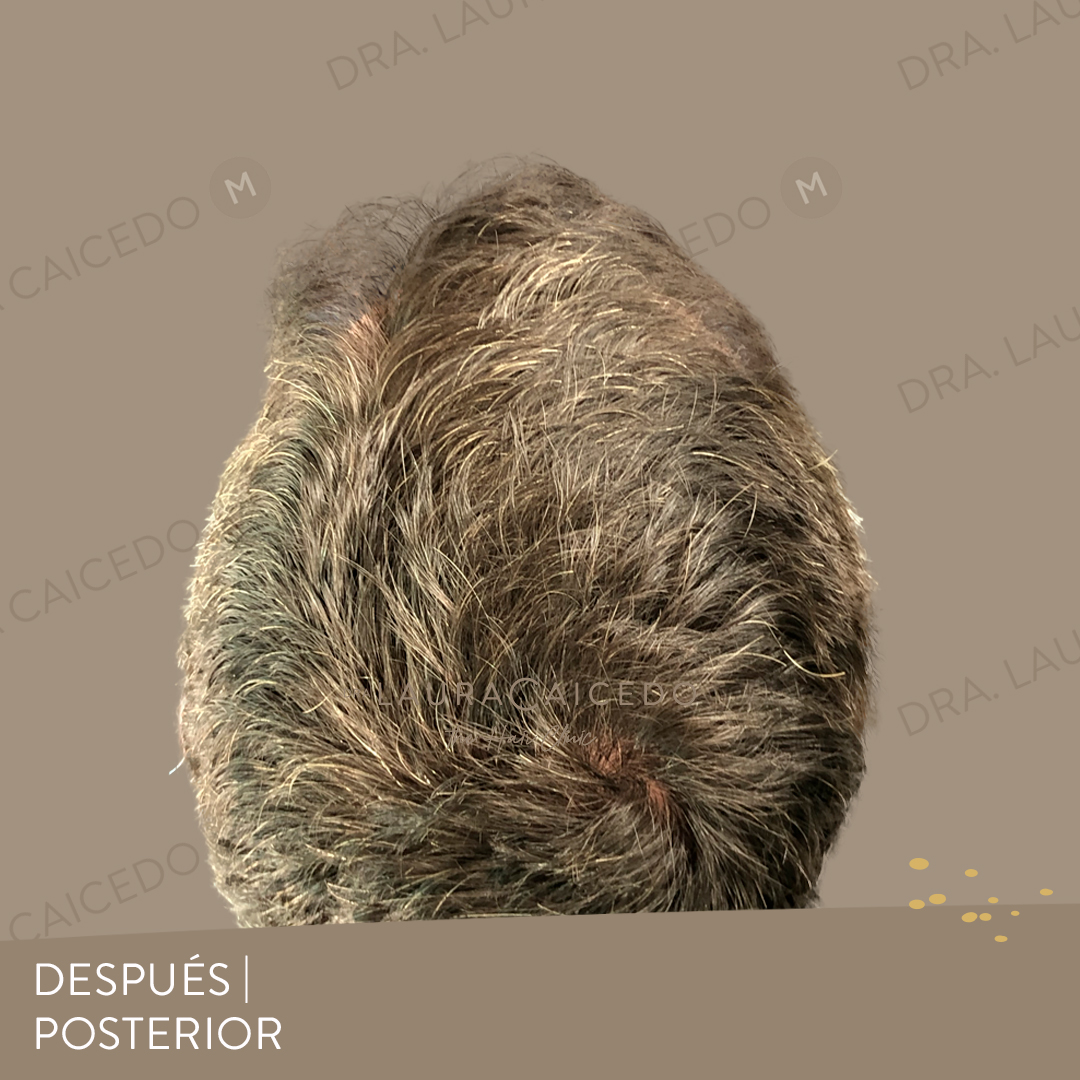Casos 18 antesdespues 07 1