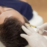 Tratamiento capilar con exosomas