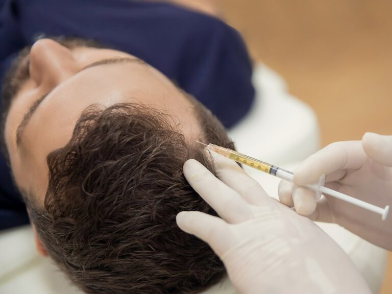 Tratamiento capilar con exosomas